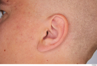 Jerome ear 0001.jpg